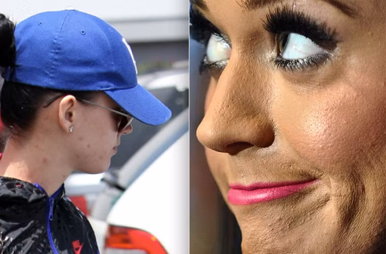 Dù đã cố gắng trang điểm nhưng làn da của Katy Perry vẫn làm cô ngại ngùng mỗi khi xuất hiện.