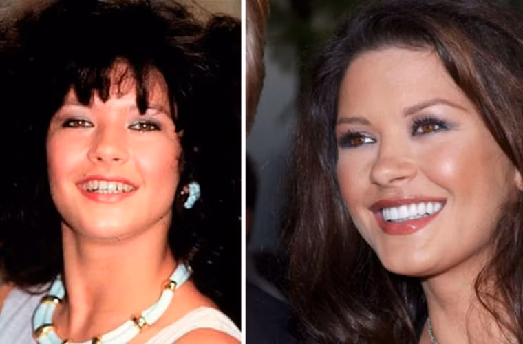 Khuôn mặt của Catherine Zeta-Jones không thay đổi là mấy trừ hàm răng hiện tại của cô đẹp hơn rất nhiều so với trước.