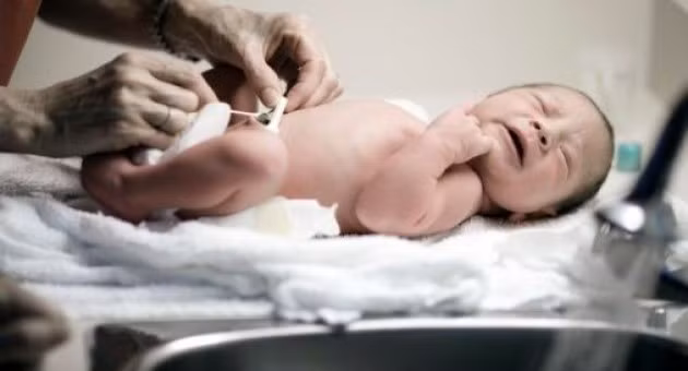 Tắm và lau rửa rốn quá thường xuyên. Tắm và lau rửa rốn cho bé thường xuyên cho bé là một phương pháp chăm sóc sai lầm, là nguyên nhân dẫn đến tình trạng rốn lâu rụng hay viêm nhiễm rốn cho trẻ. Tuyệt đối không ngâm cuống rốn của trẻ trong khi tắm cho đến khi cuống rốn đã rụng và khô.