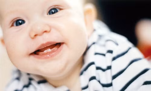 Ban có thể làm giảm các triệu chứng đau do mọc răng bằng cách cho bé một vật gì đó để nhai, gặm. Khăn mặt ướt lạnh hoặc vòng ngậm mọc răng bằng cao su cho bé cũng có tác dụng tốt. Việc mát-xa nhẹ nhàng nướu răng của bé bằng ngón tay bạn cũng có thể giúp bé cảm thấy dễ chịu hơn.