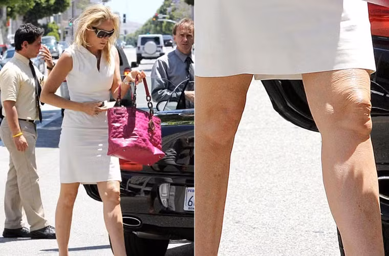 Đôi chân của Sharon Stone nhăn nhúm như chân bà lão 80.
