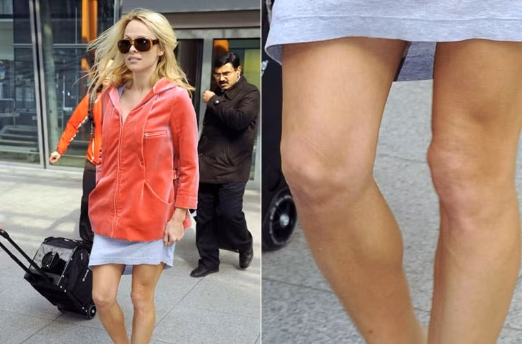 Pamela Anderson cũng không giấu được tuổi tác với hai cái đầu gối nhăn nhúm.