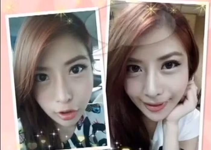 Mặc dù được cho là thành công trong ca phẫu thuật, nhưng Dora cũng cảnh báo người khác về những nỗi sợ và nỗi đau đớn mà cô phải chịu đựng trong quá trình phẫu thuật thẩm mỹ.