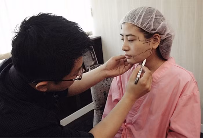 Việc đánh dấu xác định vị trí trên khuôn mặt là rất cần thiết. Bác sĩ cho biết, chỉ một chút sai sót có thể khiến bệnh nhân bị liệt cằm, không thể mở và đóng miệng, rối loạn dây thần kinh mặt cùng nhiều biến chứng khác.