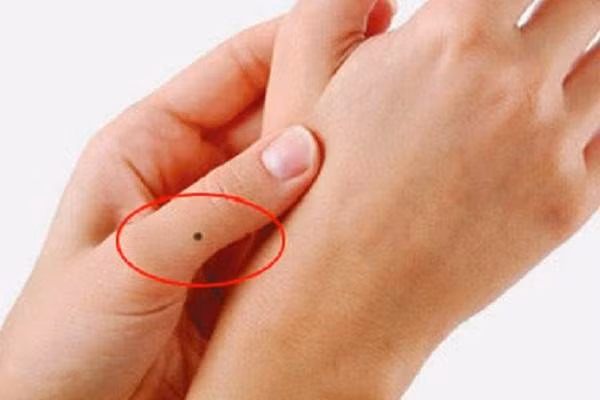 Nốt ruồi trên ngón tay. Nhân tướng học có nói người sở hữu nốt ruồi trên ngón tay là nắm trong tay may mắn. Dù nốt ruồi xuất hiện ở ngón tay nào thì cũng là điềm lành.