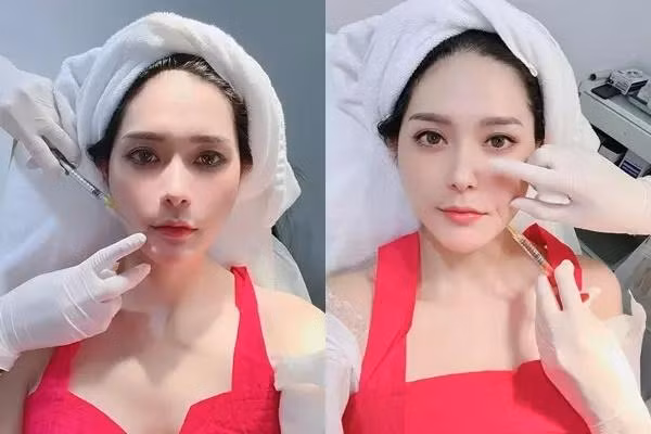 Đoàn Di Băng véo mũi khẳng định "hàng real" không dao kéo - Hình 4 Doan Di Bang veo mui khang dinh