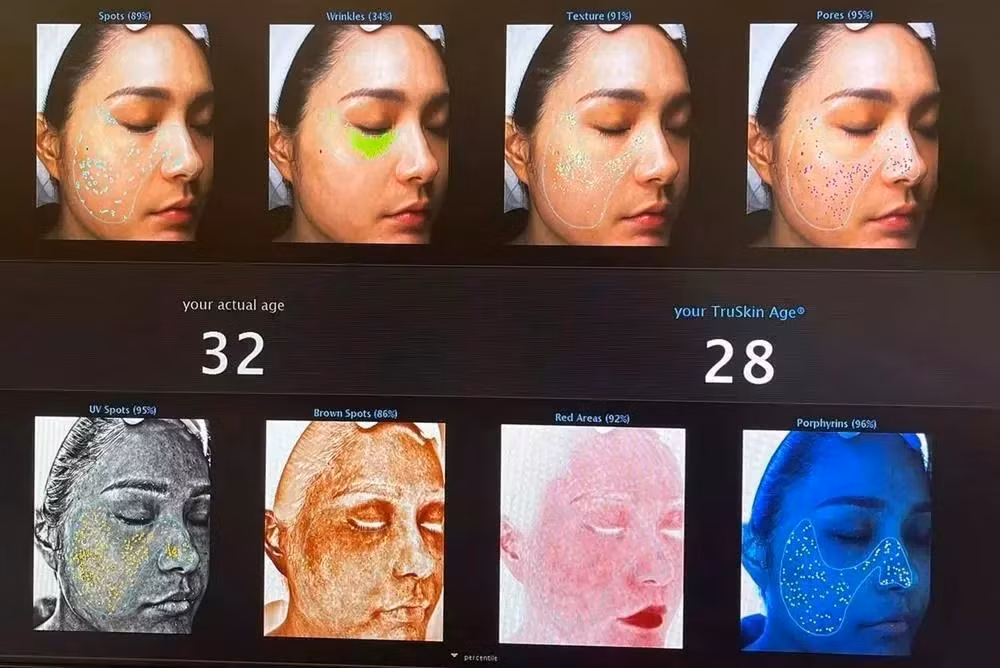 Đoàn Di Băng véo mũi khẳng định "hàng real" không dao kéo - Hình 6 Doan Di Bang veo mui khang dinh
