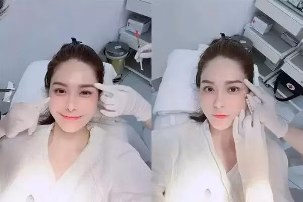 Đoàn Di Băng véo mũi khẳng định "hàng real" không dao kéo - Hình 5 Doan Di Bang veo mui khang dinh