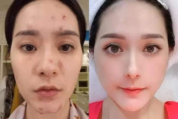 Đoàn Di Băng véo mũi khẳng định "hàng real" không dao kéo - Hình 2 Doan Di Bang veo mui khang dinh