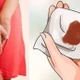 Ra máu kinh bất thường, phát hiện u xơ dễ gây hiếm muộn