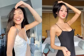 Nữ TikToker Việt mất triệu follow vì nâng ngực