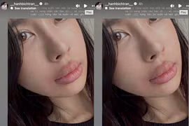 Bạn gái Vũ Văn Thanh xuất hiện với đôi môi sưng vù gây chú ý