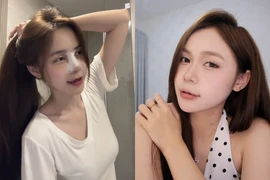 Hot Tiktoker La Hoàng Kỳ Duyên sửa mũi để "nâng tầm" nhan sắc