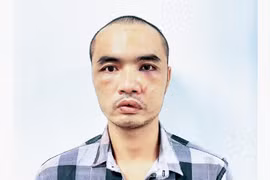 Lý lịch của đối tượng cầm dao chém nhiều ô tô ở Hà Nội