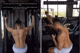 TikToker Trí Thịt Bòa ra sao sau 2 tháng gãy chân vì pickleball