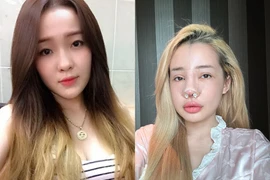 10 năm qua, Ngân 98 từng 'nghiện' phẫu thuật thẩm mỹ ra sao?