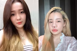 10 năm qua, Ngân 98 từng 'nghiện' phẫu thuật thẩm mỹ ra sao?