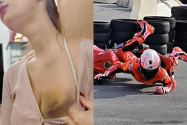 Gặp tai nạn khi lái mô-tô, gái xinh khiến fan xót xa