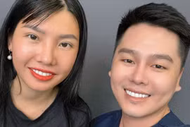 Sau 8 năm 'dao kéo', diện mạo của 'Thị Nở tái sinh' Quách Phượng gây bão