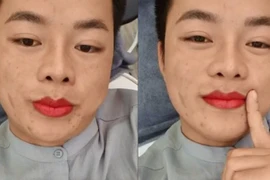 Diện mạo khác lạ của chú rể Hoa Cương sau lần được vợ đưa đi thẩm mỹ