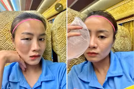 Fan xót xa trước gương mặt sưng vù của hot girl bóng đá Hoàng Thị Loan