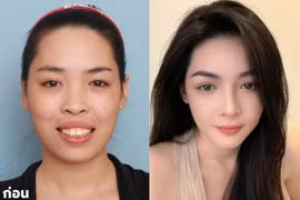 10 năm sau ca phẫu thuật 'đổi đời', Vũ Thanh Quỳnh giờ ra sao?