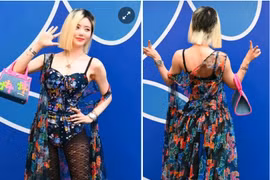 'DJ gợi cảm nhất Hàn Quốc' không còn che giấu mái tóc bị rụng cả mảng