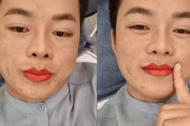 Diện mạo khác lạ của chú rể Hoa Cương sau lần được vợ đưa đi thẩm mỹ