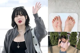 'Mỹ nhân gợi cảm nhất showbiz' HyunA để lộ dấu hiệu đáng lo