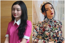 Cô gái miền Tây 'vịt hóa thiên nga' nhờ thẩm mỹ giờ ra sao?