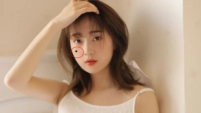 Năm nốt ruồi 'may mắn', quý nhân giúp đỡ lãnh đạo thương