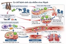 Nguy cơ virus Nipah, chuyên gia cảnh báo các dấu hiệu 'đèn đỏ' đặc biệt