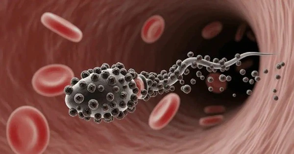 Robot 'zombie' dẫn thuốc trị ung thư từ thứ không ai ngờ tới