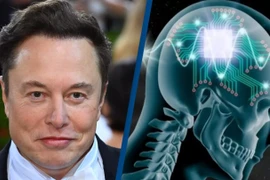Neuralink của Elon Musk lập kỷ lục cấy chip não 1,5 giây