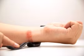 Thủ phạm khiến cổ tay ngứa điên đảo khi đeo đồng hồ dây silicone?