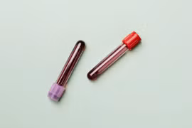 Nhật Bản tạo máu nhân tạo 'vạn năng', không cần làm lạnh 