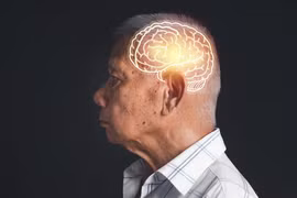 Chỉ cần 3.000 bước mỗi ngày có thể giúp bảo vệ não khỏi bệnh Alzheimer