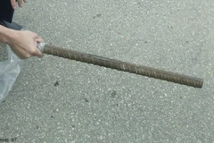 30 tuổi vẫn chưa chịu lấy chồng, cô gái Trung Quốc bị mẹ đánh thâm tím mặt mày