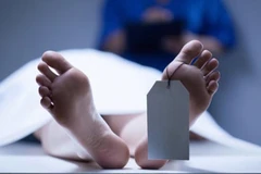 Chấn động: Công ty Mỹ có thể hồi sinh người chết não