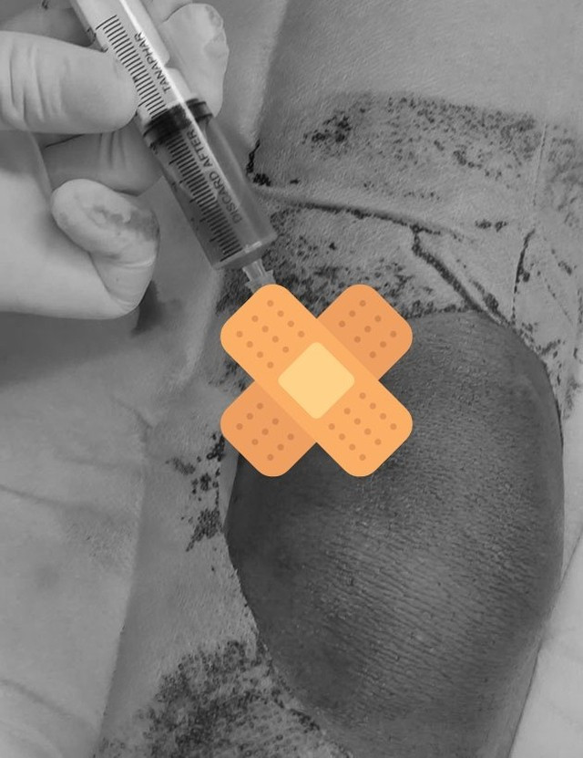 Các bác sĩ can thiệp điều trị cho trẻ. Ảnh: BVCC. Các bác sĩ can thiệp điều trị cho trẻ. Ảnh: BVCC.
