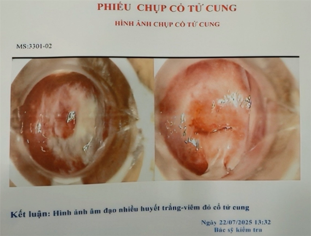 Hàng trăm hình ảnh chụp cổ tử cung bệnh lý, có mã số (ký hiệu MS) có sẵn trong máy tính của bác sĩ V.T.T.D. /Ảnh SYT Hàng trăm hình ảnh chụp cổ tử cung bệnh lý, có mã số (ký hiệu MS) có sẵn trong máy tính của bác sĩ V.T.T.D. /Ảnh SYT
