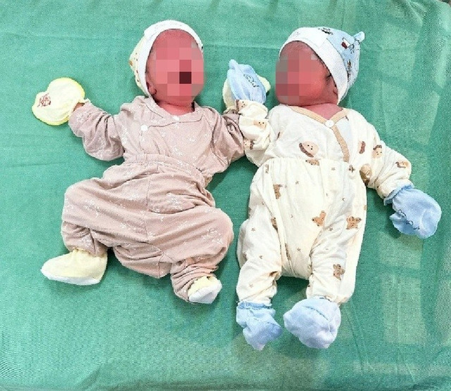 Sản phụ hạ sinh 2 bé gái đều nặng 2,8 kg. (Ảnh SKĐS) Sản phụ hạ sinh 2 bé gái đều nặng 2,8 kg. (Ảnh SKĐS)