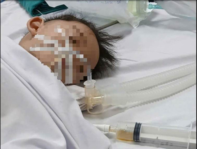 Hình ảnh bé trai 18 tháng tuổi bị đuối nước được các bác sĩ cứu sống. Ảnh: BVCC. Hình ảnh bé trai 18 tháng tuổi bị đuối nước được các bác sĩ cứu sống. Ảnh: BVCC.