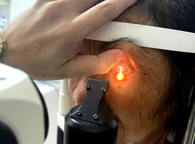Sau 4 ngày điều trị, mắt phải đạt 5/10 và mắt trái 6/10. Ảnh Sở Y tế Hà Tĩnh Sau 4 ngày điều trị, mắt phải đạt 5/10 và mắt trái 6/10. Ảnh Sở Y tế Hà Tĩnh