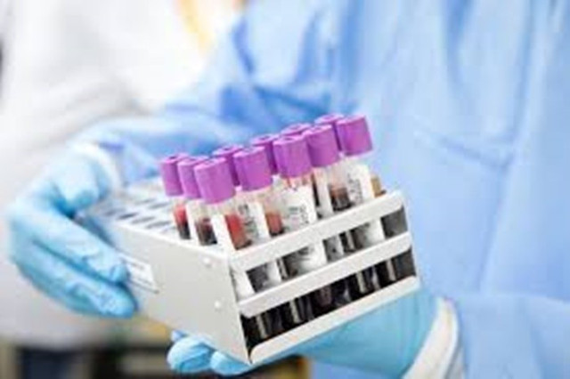NHS kỳ vọng, từ năm 2026 Galleri có thể được triển khai trên diện rộng sinh thiết lỏng, phát hiện các mảnh nhỏ của ADN chứa ung thư. Ảnh: Getty. 2.jpg