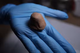 Bí ẩn bình dâng thần linh 2.000 năm tuổi ở Thổ Kỳ