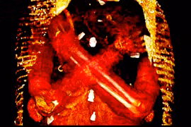 "Nội soi" xác ướp Ai Cập, bàng hoàng thấy 49 lá bùa hộ mệnh