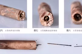 Bất ngờ phát hiện kim châm cứu bằng thép cổ nhất thế giới 