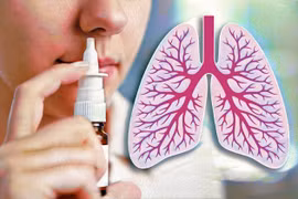 Tạo thành công vaccine DNA hỗ trợ điều trị bệnh lao dạng xịt