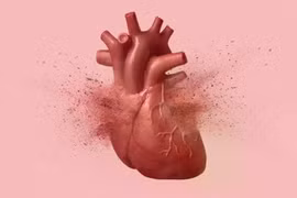 Phân biệt hội chứng 'con tim tan vỡ' và đau tim thông thường
